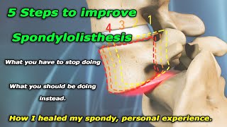 Spondylolisthesis 101 or how I healed my broken back [upl. by Danyette]