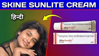 Skine Sunlite Cream Review in Hindi  by Mt discuss [upl. by Herodias]