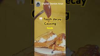 Top Foods That Cause Cavities Protect Your Teeth  Decayed Tooth [upl. by Zoba]