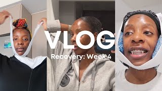 VLOG 16 Weeks 4 After Double Jaw Surgery  Heat Compress Nerve Regeneration and Popsicle Sticks [upl. by Eecyaj486]