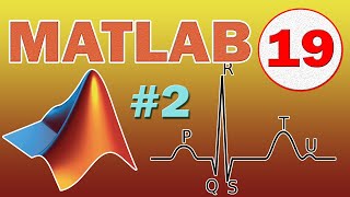 Matlab 19 Synthèse dun signal ECG Périodique  Peigne de Dirac TUTO [upl. by Calysta]