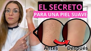 keratosis pilaris tratamiento definitivo  QUERATOSIS PILARIS [upl. by Salesin]