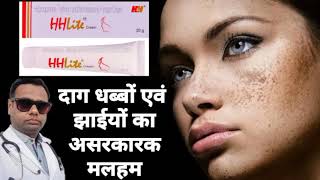 Ointment for melasma। HH lite ointment review Hydroquinone Tretinoin amp Mometasone cream। uses। [upl. by Savior]