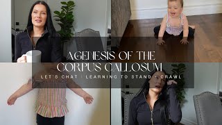 Agenesis of the Corpus Callosum  Let’s Chat  Learning to Stand  crawl [upl. by Assirem]