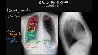 Radio du thorax  Introduction  Partie 1  Docteur Synapse [upl. by Adnwahs507]