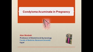 Condyloma Acuminata in Pregnancy [upl. by Mihsah997]