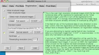 ICA Analysis Part IV GroupLevel ICA [upl. by Gokey]