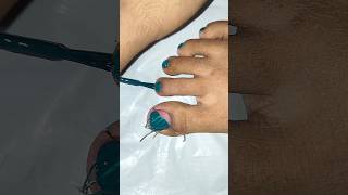 🩷💙💅Striping Tape Designsnailart toenails toenailart nails yt art viralvideos nailart short [upl. by Mahda54]