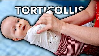 4 MONTH OLD WITH TORTICOLLIS Treated By Massage Therapist [upl. by Ellerahc]