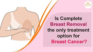 Is it necessary to remove BreastsComplete guide for patients breastcancer breastcancerawareness [upl. by Knah]