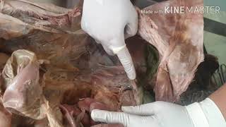 Dissection of Peritoneal Cavity by DrMeetu Agarwal [upl. by Thunell]