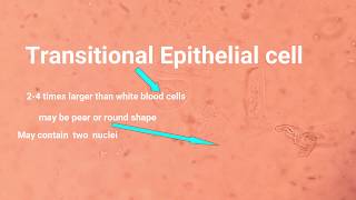 Epithelial cell types and its identification [upl. by Jobie]