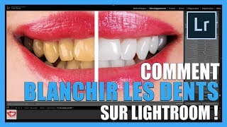 Comment blanchir les dents sur Lightroom TUTOPHOTOS [upl. by Namsu]