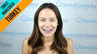 Megan Desaever  Dental Centre Turkey  Smile makeover with emax® Laminate Veneers [upl. by Showker691]