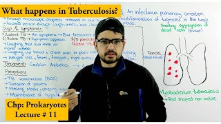 Tuberculosis TB  Causes Treatment Prevention and Transmission [upl. by Yrocej376]