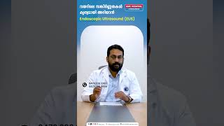 വയറിലെ സങ്കീർണ്ണതകൾ കൃത്യമായി അറിയാൻ Endoscopic Ultrasound EUS  Dr Anup S Nair [upl. by Barri]