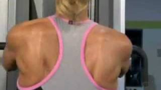 Shoulder Tendonitis Bursitis amp Impingement Syndrome  DePuy Videos [upl. by Henrietta129]