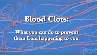 Blood Clot Prevention What You Need to Know About Deep Vein Thrombosis and Pulmonary Embolism [upl. by Inod306]