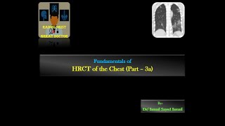 HRCT chest for Radiology Residents  Part 3a  Reticular Pattern [upl. by Esereht545]