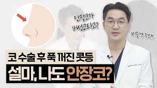 코수술 후 콧등이 푹 꺼졌어요😟 설마 나도 안장코 증상과 원인 해결방법｜비중격연골과의 관계 [upl. by Janeen]