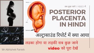 Posterior Placenta in hindi  Placenta position  placenta Grade posterior Placenta क्या होता है [upl. by Ilan]