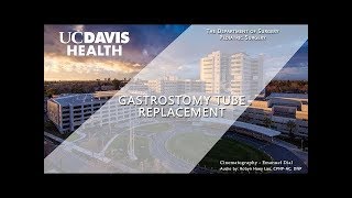 Gastrostomy Tube GTube Replacement Video  UC Davis Health [upl. by Ludeman]