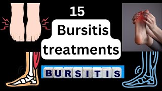 15 Bursitis treatments  heel bursitis amp achilles tendon bursitis best home treatment [upl. by Morena345]