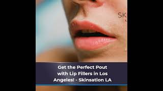 Get the Perfect Pout with Lip Fillers in Los Angeles [upl. by Eberle11]