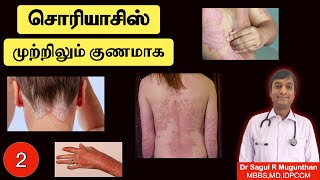 2 சொரியாசிஸ் முற்றிலும் குணமாக வழிகள்  உணவுமுறை  Psoriasis treatment  TAMIL [upl. by Sinnaoi]