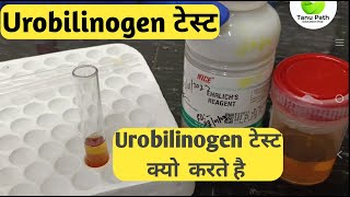 urobilinogen test [upl. by Ialocin]