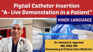 Pigtail Catheter Insertion HINDI quotA Live Demonstration in Pleural Effusionquot Dr Hemant K Agarwal [upl. by Marpet46]