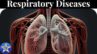 Respiratory Diseases Causes Diagnosis and Treatment [upl. by Fleisher]