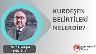 Kurdeşen Belirtileri Nelerdir [upl. by Yednarb859]