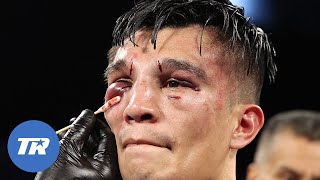 Emanuel Navarrete Breaks Joet Gonzalez Face Retains Belt by Unanimous Decision  FIGHT HIGHLIGHTS [upl. by Eliathan]