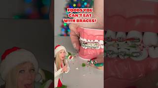 FOODS YOU CANT EAT WITH BRACES 🧐👀 ORTHODONTIST TRIES AND REACTS RIBBON CANDY FOOD ASMR shorts [upl. by Salkin]