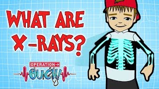 How do XRays Work  Broken Bones  Operation Ouch [upl. by Nial326]