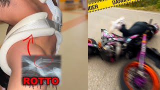 CRASH in moto e mi rompo la clavicola ðŸ¤• [upl. by Dudley]