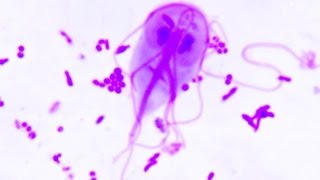 Giardia lamblia  duodenalis  Ogoniastek jelitowy [upl. by Notgnirrac]