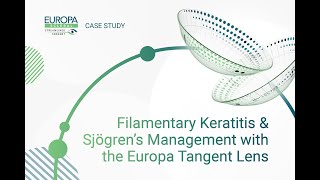 Filamentary Keratitis amp Sjögren’s Management with the Europa Tangent Lens [upl. by Naujal73]