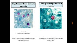 Para Findings 7 Cryptosporidium Cyclospora and Cystisospora in Stool with MZN stain [upl. by Arman]