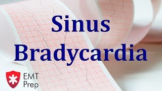 Sinus Bradycardia ECG  EMTprepcom [upl. by Orola590]