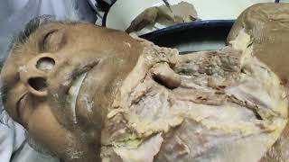 Dissection video by Dr Arnab sir Malda medical college [upl. by Austen952]