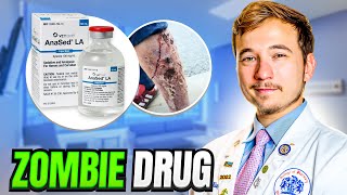 Flesh Eating Zombie Drug Spreading Across the US  Doctor Explains [upl. by Imoyik]