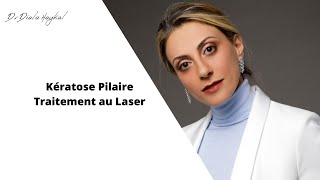 🔴Kératose pilaire Traitement au Laser [upl. by Nnylhsa829]