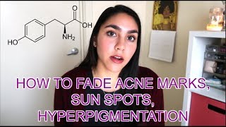 How to Fade Acne Marks Sun Spots Hyperpigmentation  Skin Lightening Agents  KAYA EMPIRE [upl. by Ahsaetan]