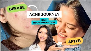 All about my SKINCARE  Shivani Yash Mathadhikari [upl. by Pinto]