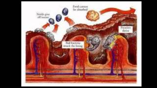 Food Grade Diatomaceous Earth [upl. by Llerej326]