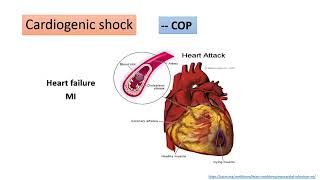 MEDLEVEL2CVS217PHYSIOLOGYCIRCULATORY SHOCK AND BASIC PRINCIPLES OF MANAGEMENT [upl. by Airrotal961]