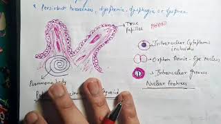 Papillary Carcinoma of Thyroid Pathology [upl. by Nahaj]