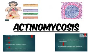 ACTINOMYCOSIS  IMAGES  MCQs [upl. by Ecitsuj]